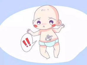 知識點 新生兒臍帶怎么護理