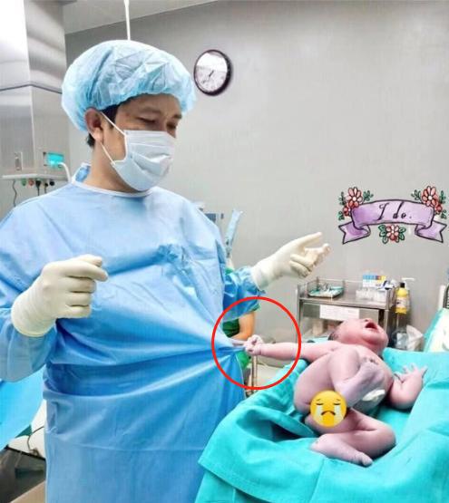 剛出生的嬰兒拉住醫生的手術服,照片萌翻網友 剛剛是你打我屁股