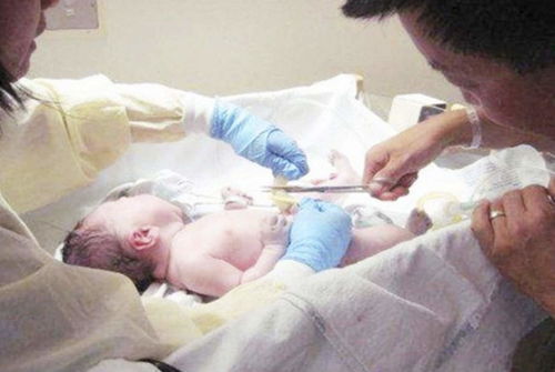 助產大夫被新生兒 碰瓷 ,網友笑評 如此記仇,長大怕是不好惹