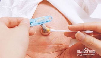 新生兒臍帶怎么護(hù)理呢