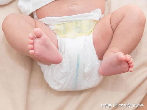 新生兒寶寶的肚臍如何護(hù)理