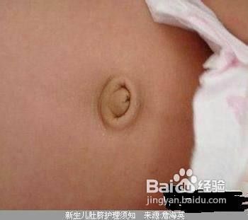 新生兒的臍帶應該怎么護理呢