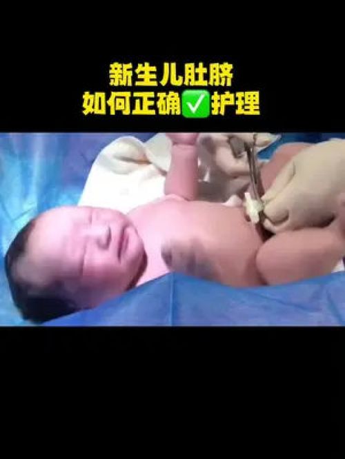 新生兒肚臍如何正確護理,新生爸媽趕緊收藏學起來 新生兒 臍帶掉落 肚臍貼 母嬰好物