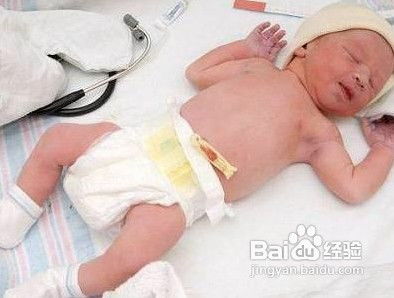 夏天怎么護理新生兒