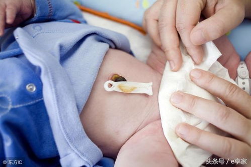 神奇的 臍貼 , 哪里痛了貼哪里