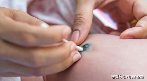 剪臍帶時寶寶為何會大哭 真的很疼嗎 醫生說出原因,媽媽放心了