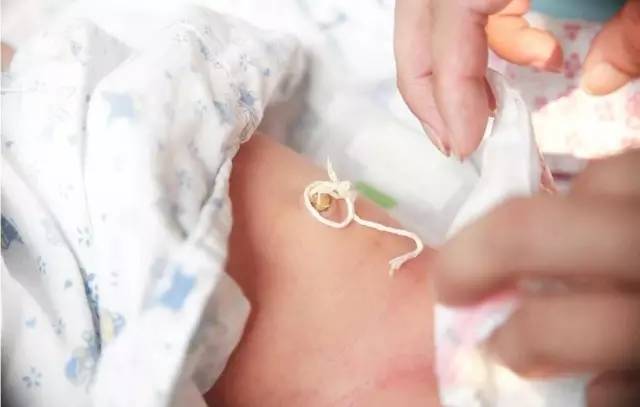 新生兒臍帶護(hù)理之四步驟與護(hù)理液使用指南