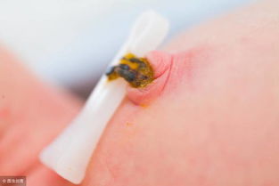 新生兒臍帶護(hù)理你真的學(xué)會(huì)了嗎？4大注意事項(xiàng)，新手爸媽請(qǐng)收藏