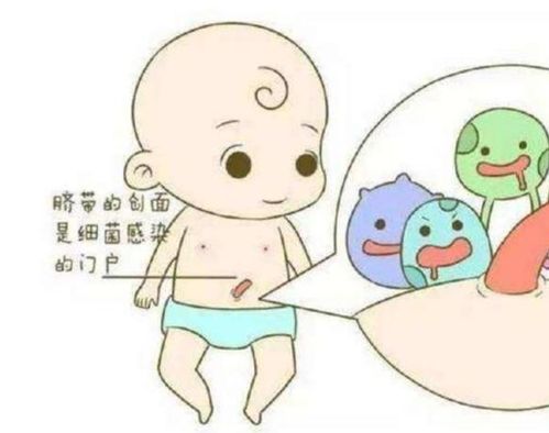 新生兒臍帶護(hù)理全攻略 如何正確使用護(hù)理液