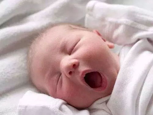 0-1歲寶寶常見疾病護(hù)理要點(diǎn) 黃疸、肺炎、鵝口瘡、濕疹及臍帶護(hù)理